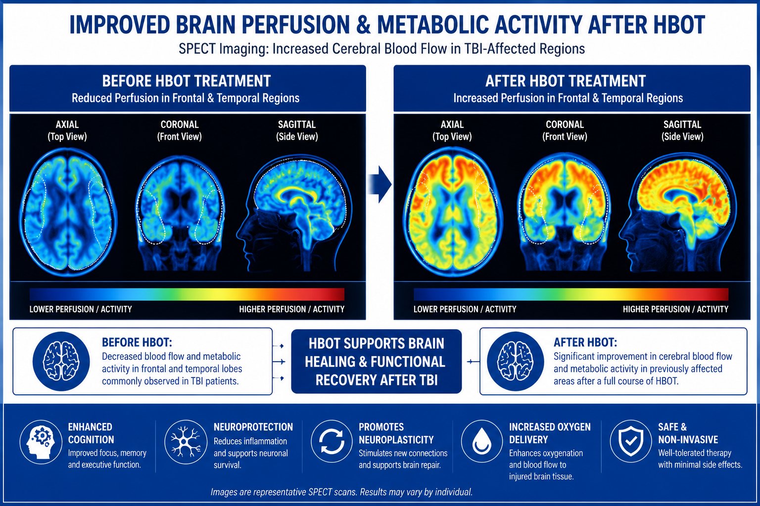 Brain scan comparison showing neurological changes after HBOT for traumatic brain injury